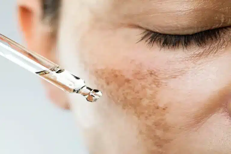 Pigmentation