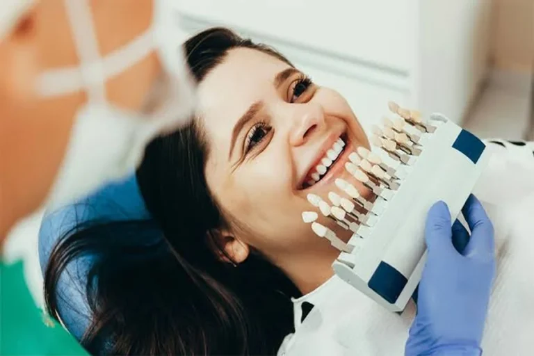 Professional Teeth Whitening Appointment
